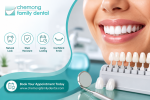 porcelain veneers in peterborough are they worth the investment