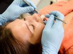 white or silver fillings what’s best for your smiling teeth